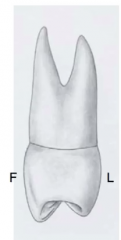 maxillary 1st premolar