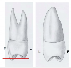 -the size and position of the cusps on the 2nd premolar are more identical 
-the height of the cusps on the 2nd premolar are equal in height unlike the 1st premolar