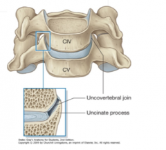 This is a curved lip of cervical vertebrae bodies that forms the uncovertebral joint with the superior vertebra.