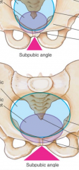 subpubic angle & pelvic aperture