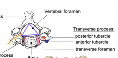 Transverse Foramina
From C6 through atlas then they wrap around and enter the skull through the Foremen magna