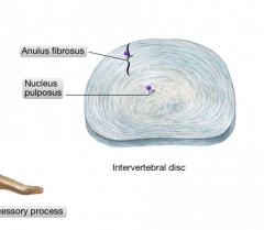 The anulus fibrosus (firmly bound to the bodies) and the nucleus pulposus (which is a highly hydrated colloid that derives from the neural tube of the embryo)
