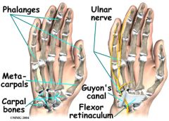 It is formed by a bridge of the pisohamate ligament, the hook of the hamate, and the pisiform. The ulnar nerve and artery can be compressed here,