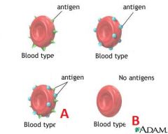 Identify the blood types for A and B and their respective alleles.

A is displaying what degree dominance?