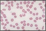 Name this cell and its indication