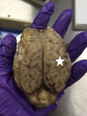 Identify this lobe of the brain.