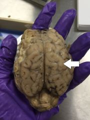 Identify this structure of the brain.