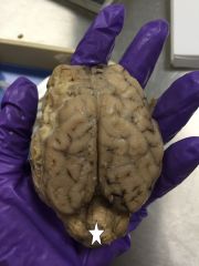 Identify this lobe of the brain.