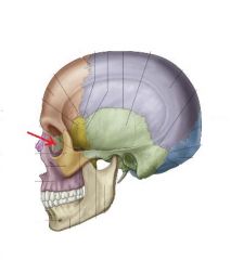 This facial bone forms the medial most aspect of the orbit. 