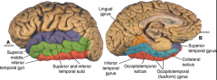 primary auditory

of temporal lobe