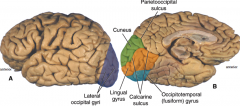 visual processing

occipital lobe