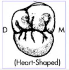 3 cusp type heart shape
-as you move progressively towards the posterior the cusps gets smaller and therefore the disto-lingual cusp of a maxillary 2nd molar is sometimes missing 