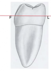 mandibular 1st molar
*note that the maxillary 1st molar has the largest facio-lingual length of ALL teeth