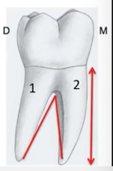 mandibular 1st molar
*note that eh maxillary canine has the longest root of ANY tooth