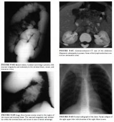 A I 5-year-old boy presents with fever, cough, abdominal pain, and diarrhea.