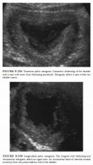 A previously healthy 3-year-old boy with 2 days of enuresis, dysuria, and hematuria.