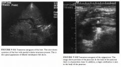 A 5 1 -year-old woman presents to the emergency room with weight loss, loss of
appetite, and vague abdominal pain.
