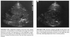 A 26-year-old woman presents for routine obstetric ultrasound.