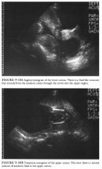 A 26-year-old woman referred for fetal ultrasound because of uncertainty
about her dates.