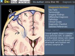 Sinus pericranii

Case findings:
Small, oval-shaped flow-void within the mid-anterior parietal scalp
Lesion communicates with superior sagittal sinus and an adjacent dilated scalp vein  abnormal communication between intracranial and extracranial ven
