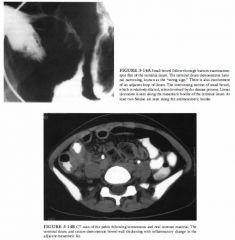 A 35-year-old man presents with a 6-month history of diarrhea.