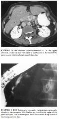 A 67-year-old woman presents with abdominal pain and weight loss.