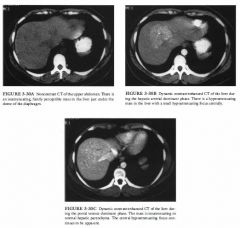 A 42-year-old woman presents with vague abdominal pain.