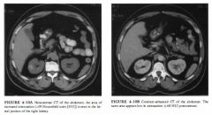 A 54-year-old man presents with abdominal pain.