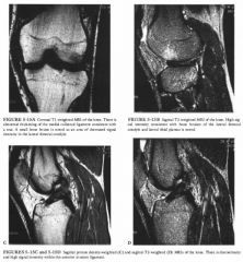 A 28-year-old man who twisted and injured his knee.