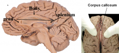 i) Genu - connects prefrontal cortex
						ii) Body - connects motor/sensory/parietal corticies
						iii) Splenium - connects temporal/occipital lobes