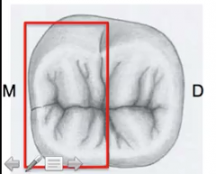 the largest facio-lingual diameter is in the mesial 1/3 side