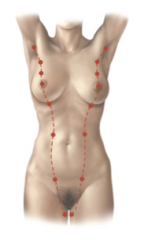 A ridge of ectoderm known as the mammary ridge that gives rise to breast in the pectoral region while the rest of the line dissipates. Accessory mammary glands and nipples can appear if there is not complete involution of the lines.