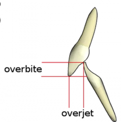 overjet = horizontal overlap (front and back)
-usually 2-4mm

overbit = vertical overlap (up and down)