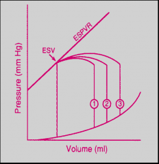 *Holding afterload and contractility constant

*Varying “preload” measured as end-diastolic volume