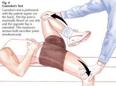 SIJ dysfunction (1 of 5 cluster of tests)


supine near edge of the table with affected leg hanging over edge of table


-other leg is flexed toward pt's chest


-firm pressure is applied to both the hanging leg and the leg flexed toward the...