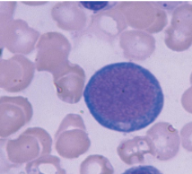 LARGE cells w/ intense blue cytoplasm & round nucleus w/ few NUCLEOLI
-committed stem cell