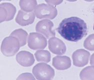 grayish cytoplasm (Hgb production), smaller condensed nucleolus
-last stage capable of division 
-first cell to make Hgb*