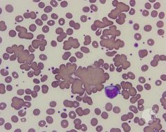 Bridging or clumping of erythrocytes