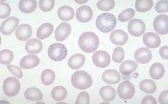 Presence of small, dark-blue bodies within the erythrocyte