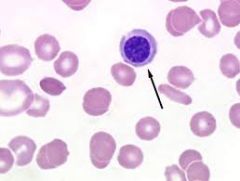 Cells released into circulation early during anemia