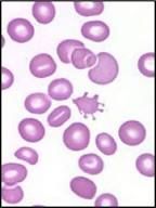 Erythrocytes with one or more surface projections