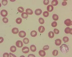 Erythrocyte with an oval-shaped central pallor