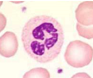 (PMNs, polys, segs) 
-most common white cell
-pale pink granular cytoplasm with condensed, segmented nucleus 
-1/2 life: 7hr
-fx: chemotaxis, phagocytosis, kill phagocytosed bacteria
