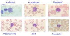 myeloblast
promyeloblast
myelocyte
metamyelocyte
band
neutrophil