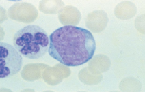 large cell, high N:C ratio
-nucleus: delicate chromatin pattern w/ few nucleoli