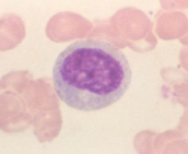 *last stage capable of division. 
-nucleus: smaller, condense, lacks nucleoli, may be eccentrically located
-cytoplasm: secondary (pink) granules
-granules specific to neutrophils/eosinophils/basophils