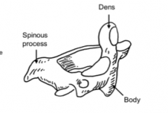 Dens/ Odontoid process