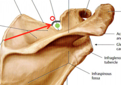 It is a ligament in the superior notch of the scapula