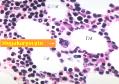 -50% fat cells
-myeloid:erythroid = 2:1 to 7:1
-megakaryocytes: 2-5 per high power field 
-plasma cells <3%
-lymphocytes <20%