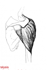 The spine of the scapula, the acromion process, the lateral third of the clavicle, and the deltoid tuberosity